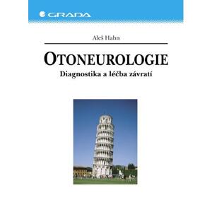 Otoneurologie: Diagnostika a léčba závratí - Aleš Hahn [E-kniha]