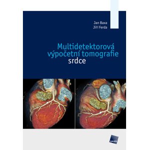 Multidetektorová výpočetní tomografie srdce - Jan Baxa, Jiří Ferda [E-kniha]