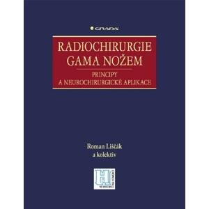 Radiochirurgie gama nožem: Principy a neurochirurgické aplikace - Roman Liščák, kolektiv a [E-kniha]