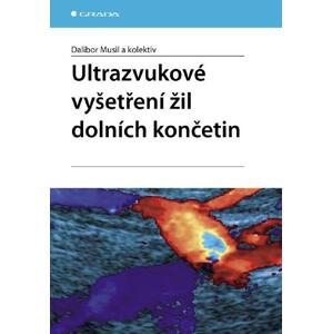 Ultrazvukové vyšetření žil dolních končetin - Dalibor Musil, kolektiv a [E-kniha]