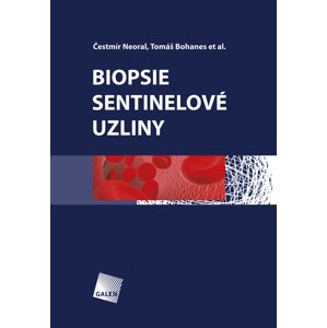 Biopsie sentinelové uzliny - Čestmír Neoral, Tomáš Bohanes [E-kniha]