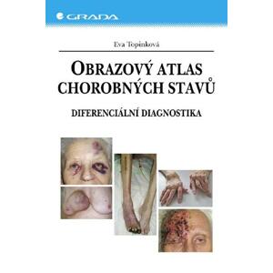 Obrazový atlas chorobných stavů: Diferenciální diagnostika - Eva Topinková [E-kniha]