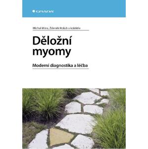 Děložní myomy: Moderní diagnostika a léčba - Michal Mára, Zdeněk Holub, kolektiv a [E-kniha]