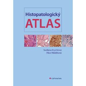 Histopatologický atlas - Svetlana Brychtová, Alice Hlobilková [E-kniha]