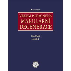 Věkem podmíněná makulární degenerace - Petr Kolář, kolektiv a [E-kniha]