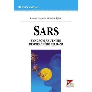 SARS: Syndrom akutního respiračního selhání - Roman Prymula, Miroslav Špliňo [E-kniha]